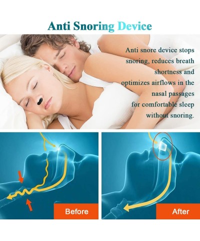 Anti Snoring Device Snore Upgrade Stoppers Snoring for Men Women 2 in 1 Nose Air Purifier Nasal Vents Plugs Clip Snoring Stop...